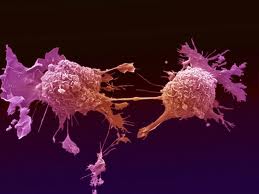 cancer azucar