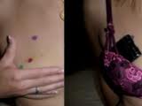 cancer de mama (1)
