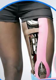 kinesiotape para rodillas
