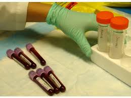 Analítica de sangre en caso de chequeo preventivo de mujeres a partir de los 40 años