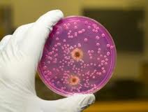La candidiasis