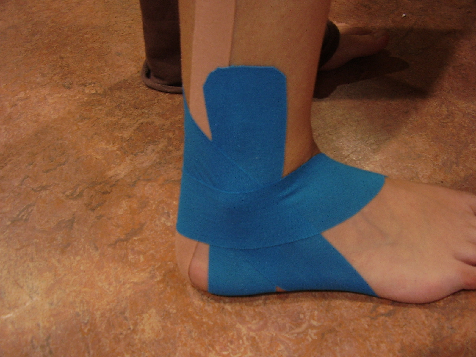 La rehabilitación de los esguinces del tobillo ES