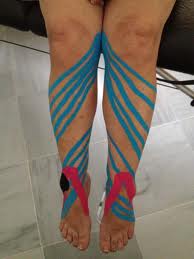 tratamiento edema