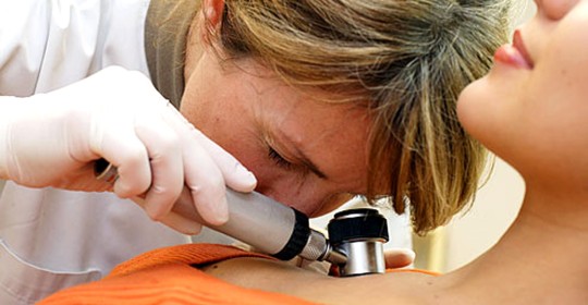 Nuevo tratamiento para el melanoma