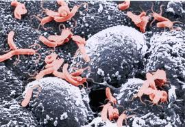 La Bacteria Helicobacter Pylori protege contra el asma