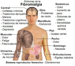 fibromialgia madrid