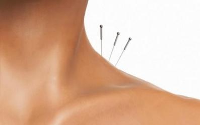 La acupuntura para el tratamiento del dolor crónico