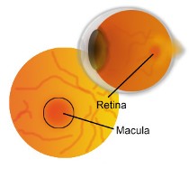 degeneración macular madrid