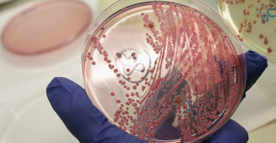 Las “superbacterias” resistentes a los antibióticos, un problema creciente