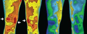 tratamiento earthing