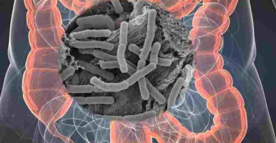 Tratamiento de la disbiosis intestinal