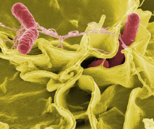 superbacterias resistentes salmonella